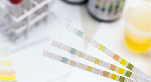 Test Strips & Diagnostics